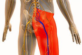Anatomical illustration of the sciatic nerve running from the lower back down through the leg